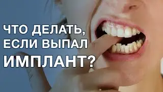 What should I do if my dental implant falls out? My dental implant is loose.