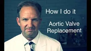 Aortic Valve Replacement  Step by Step (Step 1 of 7) *Viewer discretion is advised*