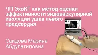 Метод оценки эффективности изоляции ушка левого предсердия
