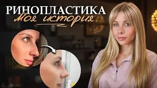 Я мечтала стать красивее, но ринопластика пошла не по плану...
