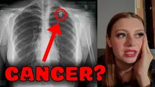 Do I Have Cancer?