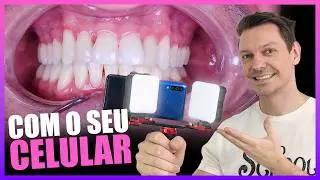 FOTOGRAFIA ODONTOLÓGICA COM O CELULAR