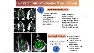 Quantification of Left heart by Echocardiography ASE