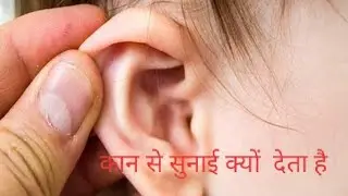 Human ear structure ..... How to sound transfer inner ear