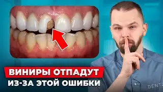 Не вздумайте это сделать с винирами! Ошибка которая все испортит