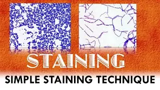 Simple staining technique / Principle / Procedure and Applications / Microbiological Insights