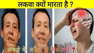 लकवा क्यों और कैसे होता है ? Paralysis attack in hindi