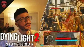 Dying Light 2’s Problem With Health Bars & HUD. (With Suggestions To Fix It)