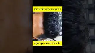Hair Patch In Raipur | Hair Patch for Men | Best Hair Patch in Chhattisgarh 
