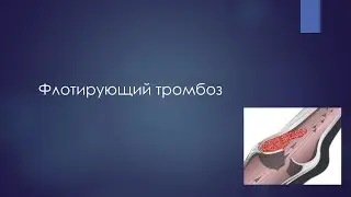 Флотирующий тромбоз v2.0