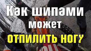 Как шипами пилит ногу (случай из жизни)