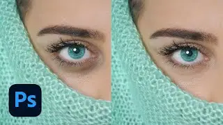 How to Remove Under Eye Dark Circles in Photoshop