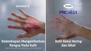 Penjagaan Terbaik Untuk Kulit Anda
