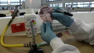Técnicas de Siembra En Medios de Cultivo: Estría