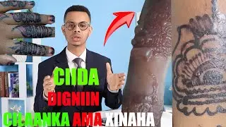 DIGNIIN 👉 𝐗𝐈𝐍𝐀𝐇𝐀 AMA 𝐂𝐈𝐋𝐀𝐀𝐍𝐊𝐀 CARUURTA LOO MARIYO CIIDA🖐🦶