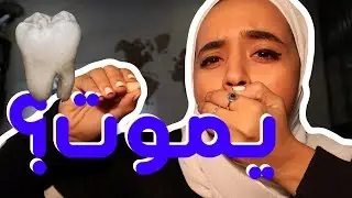 خلعت ضرس العقل 🦷😱