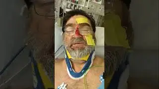 moto giant motorcycle crash