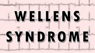Wellens syndrome