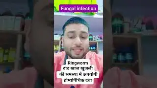 Ringworm homoeopathic medicine #shortsviral #ytshorts #shorts