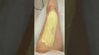 Полимерная эпиляция