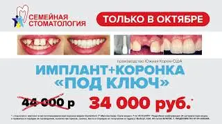 В Семейной стоматологии скидка 10000 рублей на имплантацию под ключ в октябре