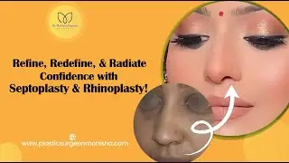 Breathing Issue Solved | Rhinoplasty Surgery Before and After | Desire Nose Rhinoplasty | Dr Monisha