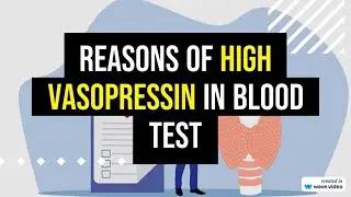 High Vasopressin Blood Test Reasons and Explanation