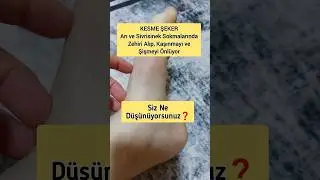 Bunu Biliyor Muydun🫨SİVRİSİNEK SOKMALARINDA 🫨🤩#keşfet #bestvideo #shorts #youtube #help #viralvideo
