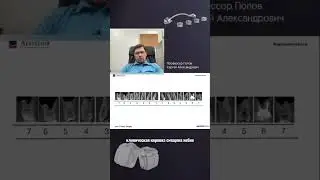 Профессор Попов об отработке торка в системе брекетов пассивного самолигирования Carriere SLX 3D