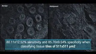 PICCOLO project results short video series: Multi-Photon Microscopy (MPM) Classifier
