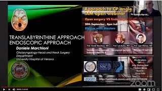 Translabyrinthine Approach Endoscopic Approach