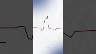 как вам контент?