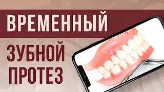 ВРЕМЕННЫЕ ПРОТЕЗЫ: удобное и эффективное решение для ВОССТАНОВЛЕНИЯ ЗУБОВ