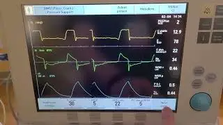Servo I P0 1 Value
