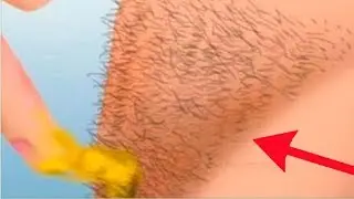 6 easy methods to get rid of unwanted hair!