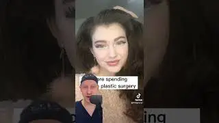 Before vs After Spending $50,000 On Plastic Surgery | Plastic Surgeon Reacts