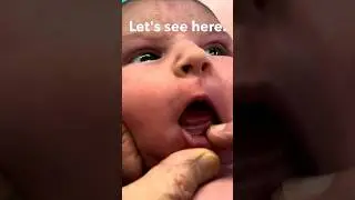 Newborn tongue check! For latch and feeding purposes 
