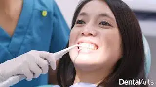 Giving you the smile you want at Dental Arts!