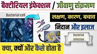 बैक्टीरियल इंफेक्शन के लक्षण, कारण, इलाज || bacterial infection kya hota hai || bacterial infection