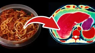 College student eats leftover pasta and this happened