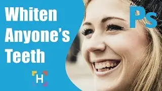 Whiten Teeth In Photoshop - Making Whitening Look Natural