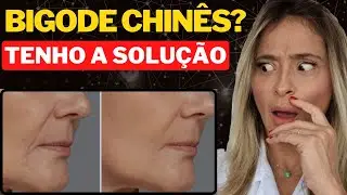 5 Tratamentos BARATOS E EFICIENTES para Rugas de Marionetes!