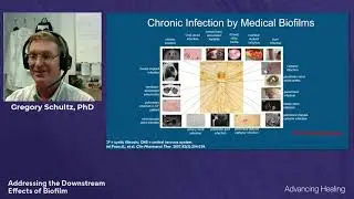 Addressing the Downstream Effects of Biofilm