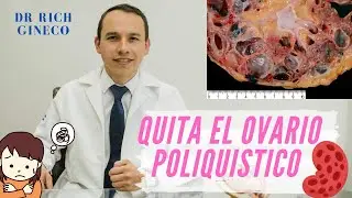 Tratamiento efectivo para Ovario poliquístico 2024