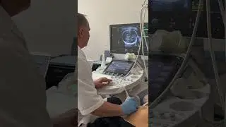 Экспертное УЗИ при беременности ( включая ультразвуковой генетический скрининг) и гинекологии🔝