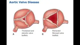 Chapter 19 Disorders of Cardiac Function BIO216