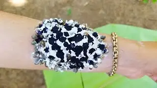 [ Remove ticks] How to cleaning ticks on human hand 
