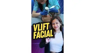 Achieve Amazing Face Lifting through V-Lift Facial