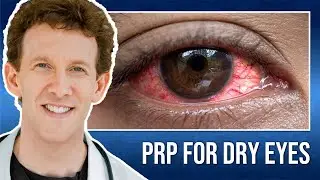 PRP Treatment for Dry Eyes with Dr. Scheiner | Kara's Testimonial