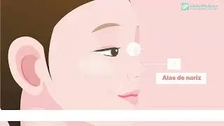 HILOS HIKO WHITEMEDIENCE  PARA RINOMODELACION INFORACION TECNICA